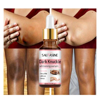 Dark Knuckles Fast Whitening Serum Pigmentation  for black skin Hand Knuckle Elbows Knee Intense Stains Remover Serum