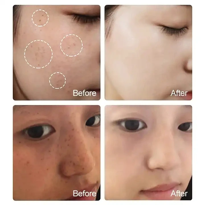 brightening serum- kojic acid & glutathione reviews Korean Skin Care Ultra Serum Kojic Acid Serum  Dark