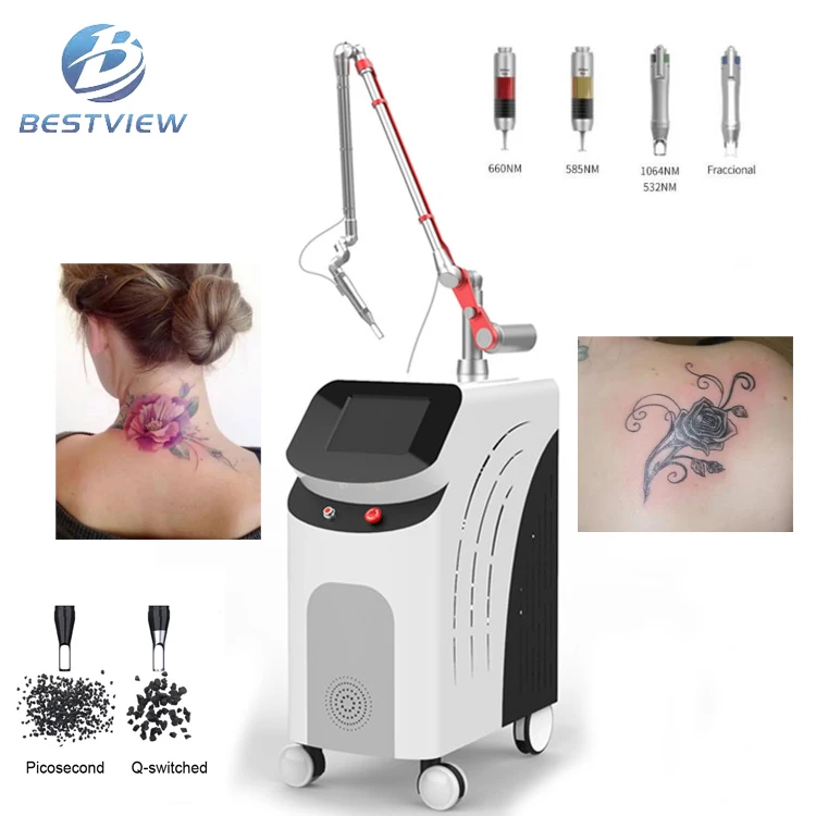 Лазер Для Удаления Тату Цена