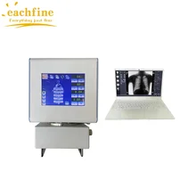 Medical Veterinary Best Price Digital Radiography System 100mA 5KW Mobile High Frequency DR Xray Machine