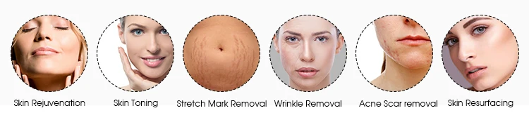 Apolo Skin Rejuvenation Skin Resurfacing 1550nm 1927nm Fiber Laser Systems for Sale details
