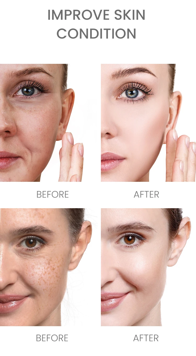 ESTELIN Skin Care Moisturizing Smoothing Reduce Fine Lines Firming Collagen Rice Serum 30ml