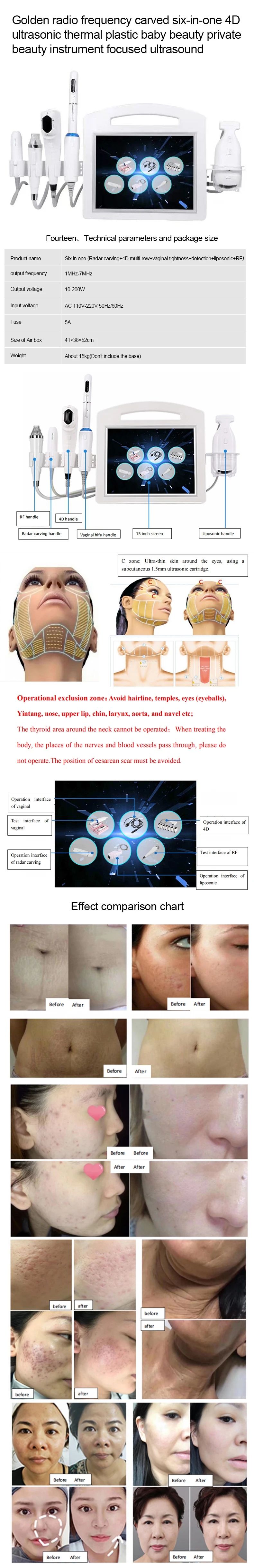 2023 6 in 1 microneedle fractional rf 4d hifu Liposonic 4D Radar Carving+Privacy+Detection function vaginal tightening device