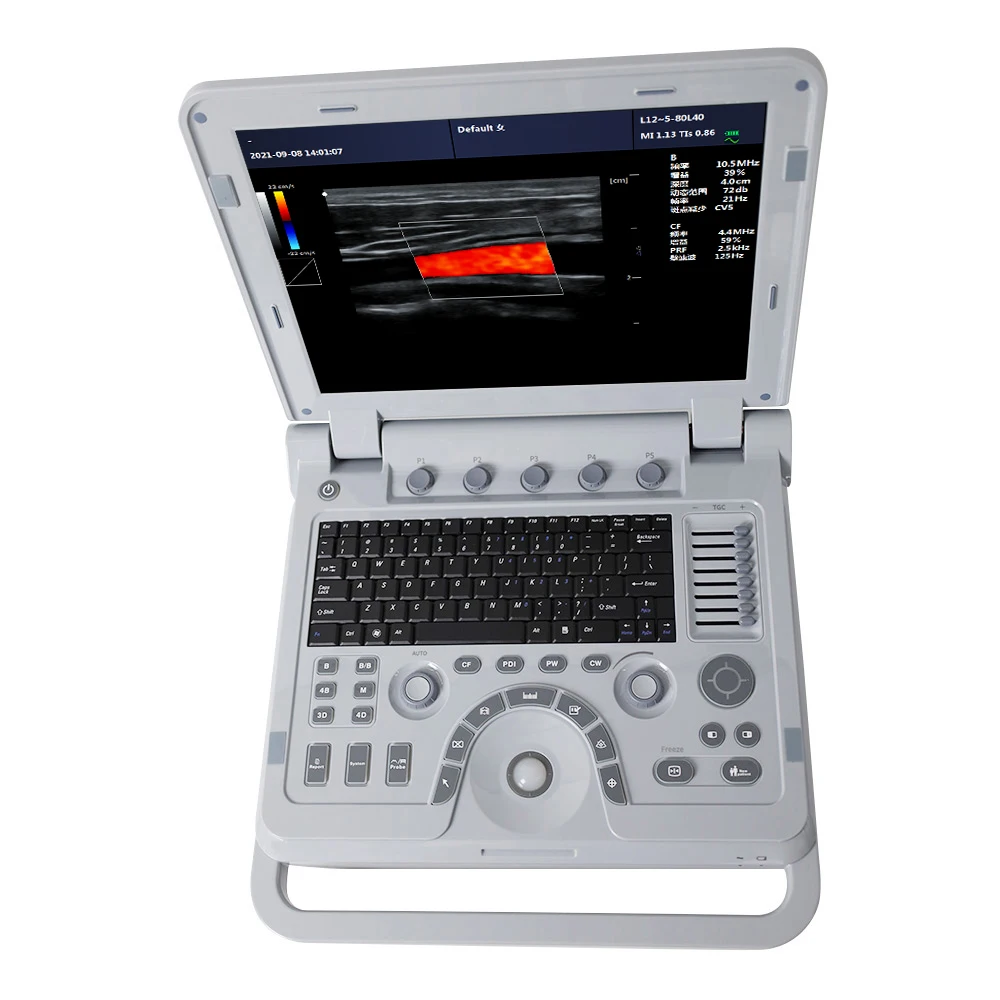 CONTEC CMS1700B Multiple 3D 4D Probe Digital Human Ultrasound Scan Ecocardiografo Color Doppler ultra Sound Machine
