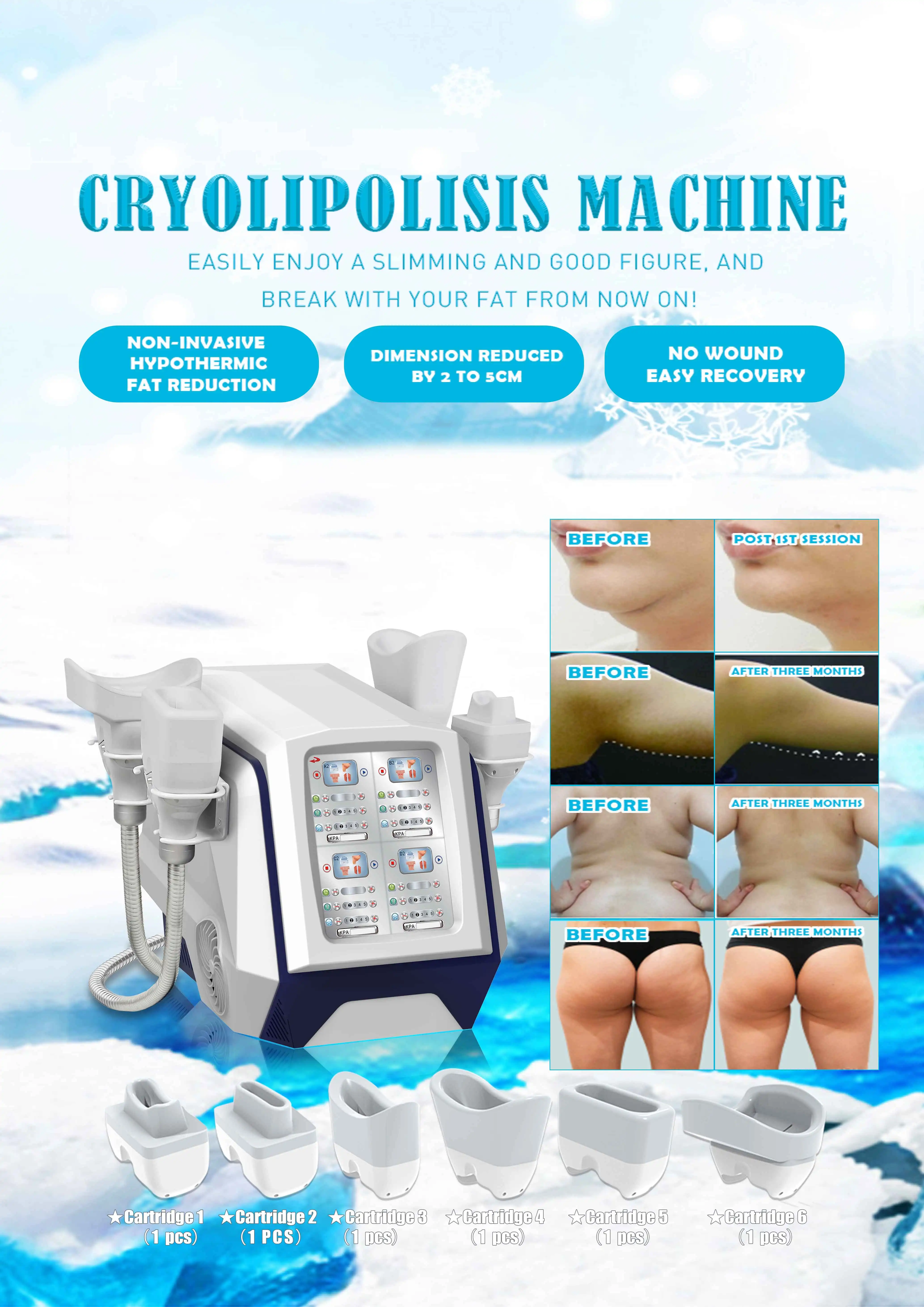 Cryolipolysis Fat Burn Weight Loss Machine