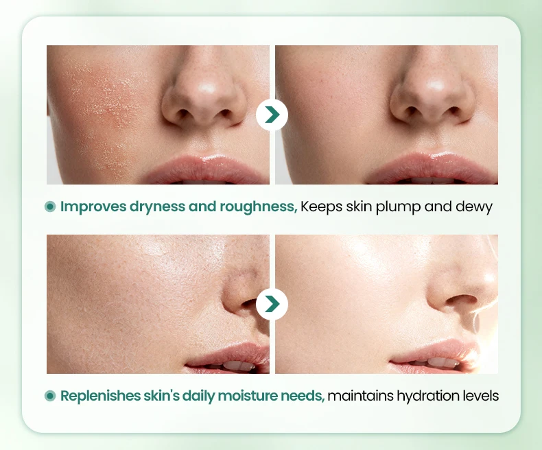 Natural Cactus Skincare Set Sodium Hyaluronate for Deep Hydration Includes Face Wash Moisturizer Soothing Repair Kit(pic5)