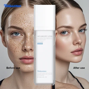 Vinissense  New OEM ODM Product Hydrating Whitening Vitamin Organic Dark Spots Removal All Skin Types 50ml Anti-Dark Spot Lotion