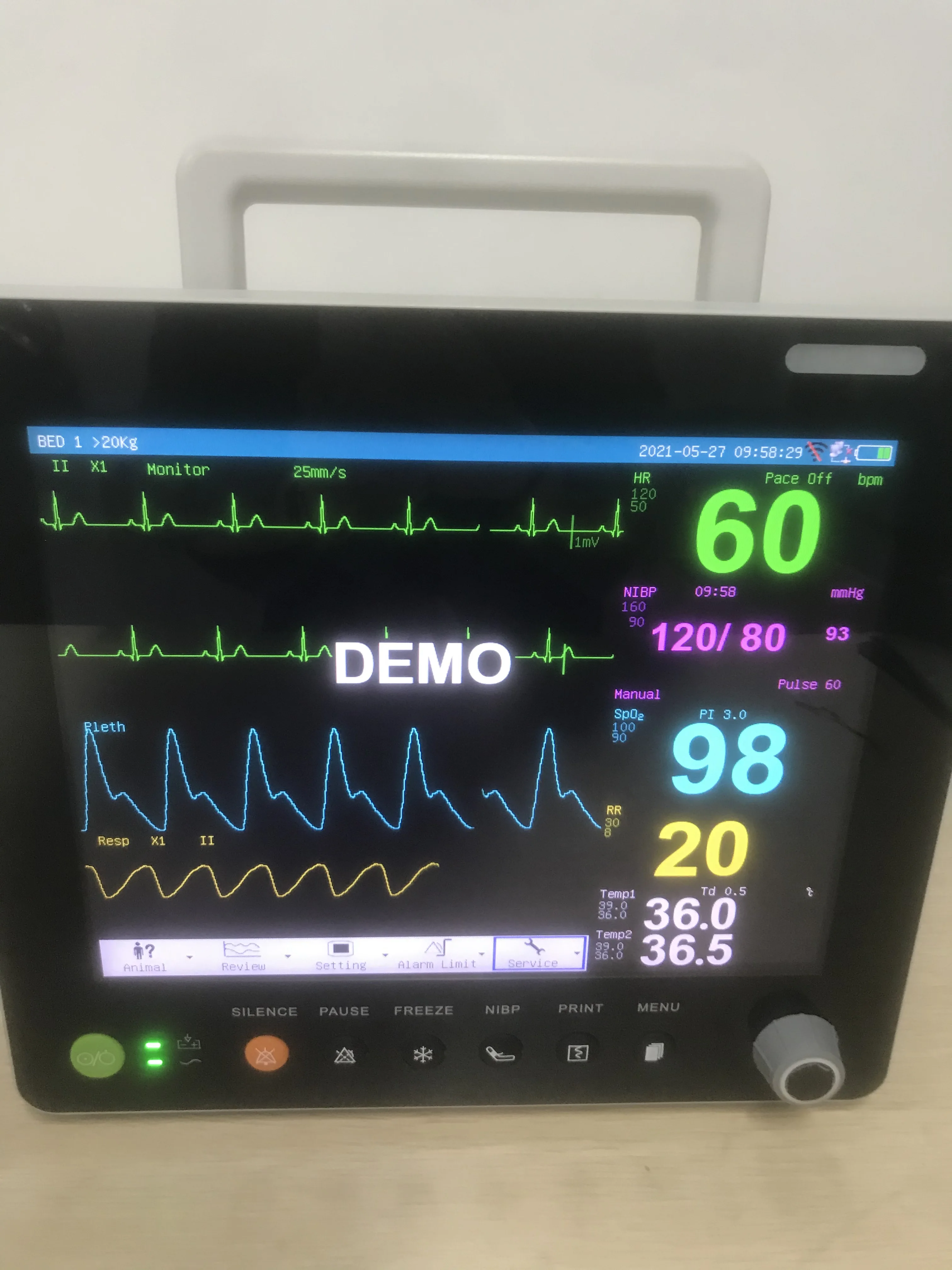 Portable Capnography Animal Use  Vet Patient Monitor Capnograph Oximeter CO2 Monitor on Sale
