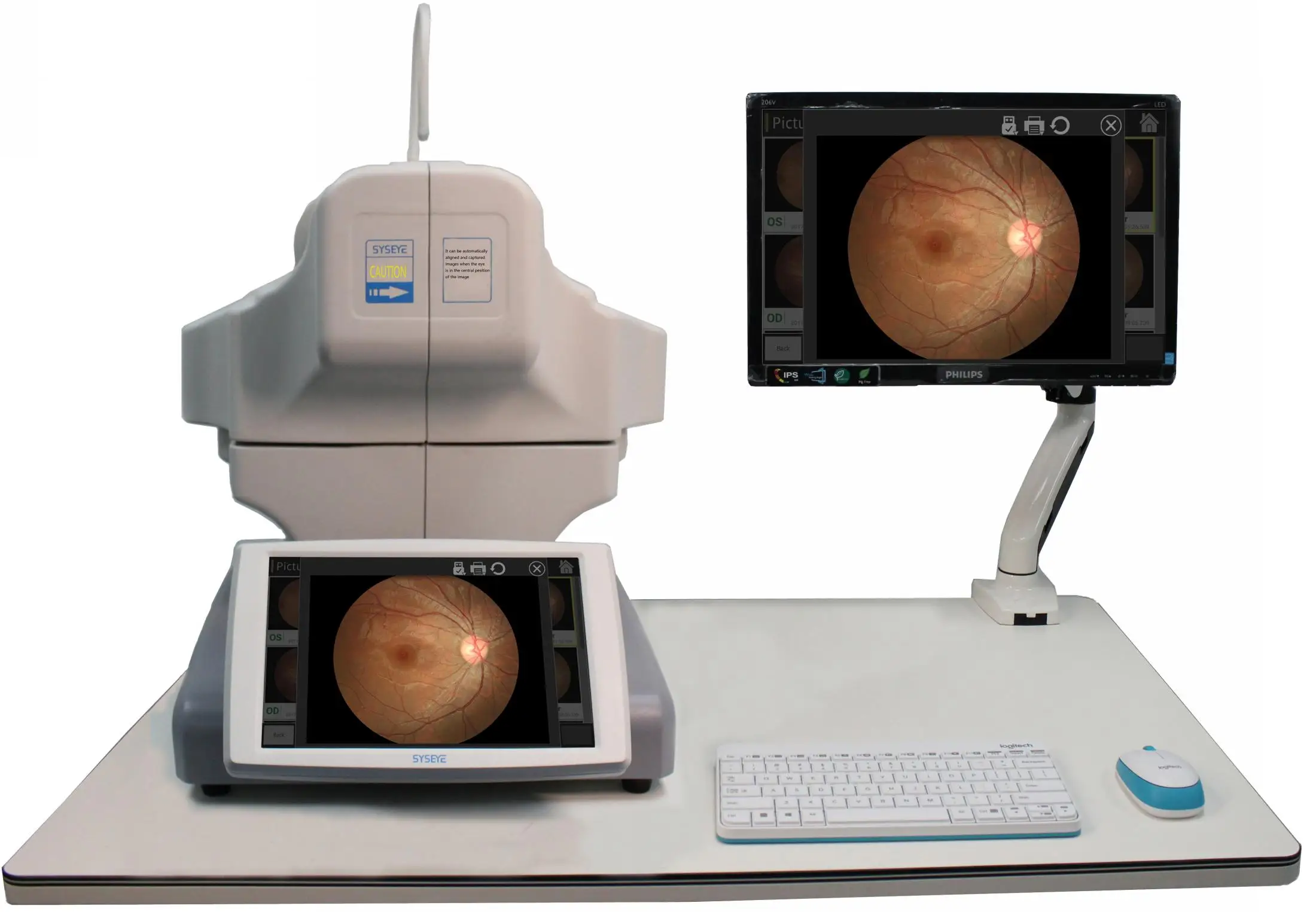 High-definition Ophthalmic Instrument Automatic Fundus Camera Reticam 3100 Optical Device High-definition Imaging