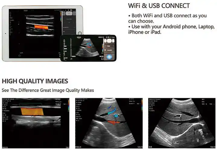 YUVNICE Veterinary Ultrasound Scanner Android Portable Ultrasound Machine Viatom 128 Elements Wireless Ultrasound Probe 3 in 1