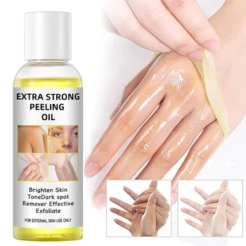 High quality Removal Dark Spot peeling oil whitening body care oil skin bleaching peeling oil