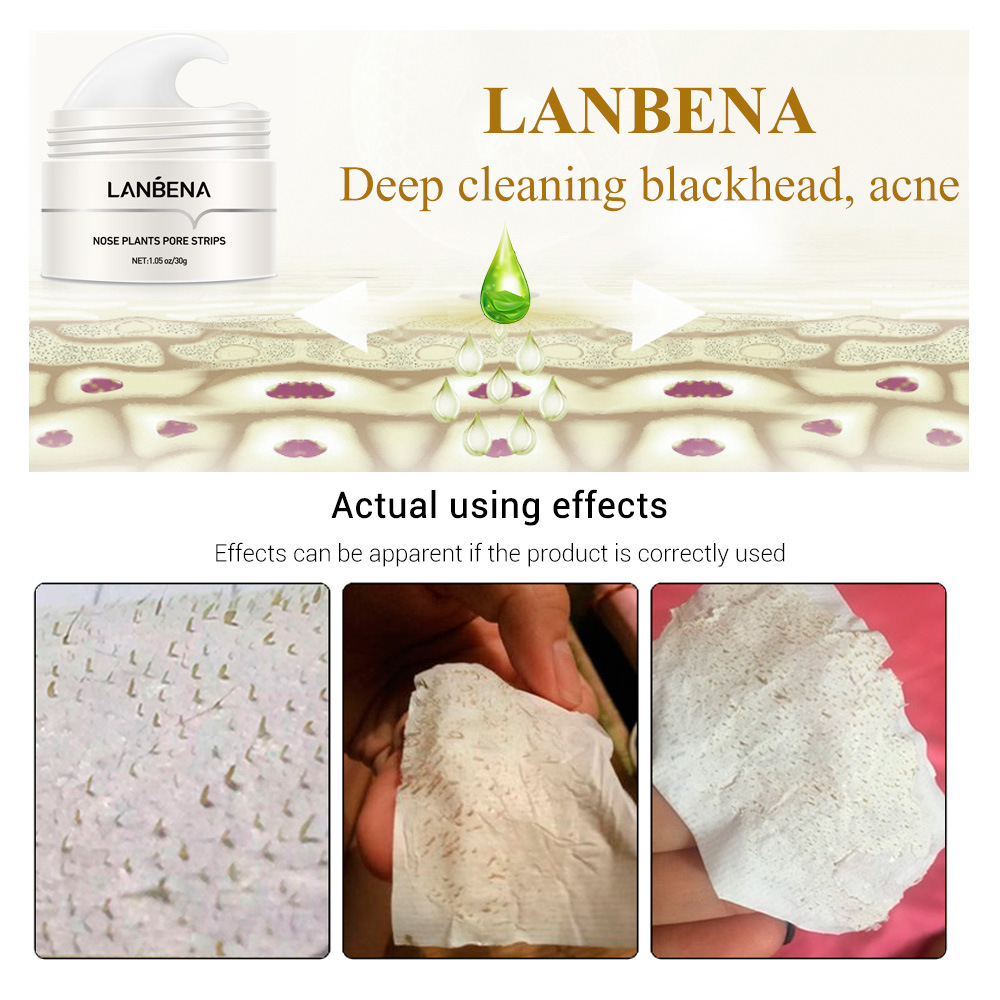 LANBENA Plants Pore Nose Strips for All Skin Types - Blackhead Remover,  Hydrating, and Moisturizing Acne Treatment (30g)