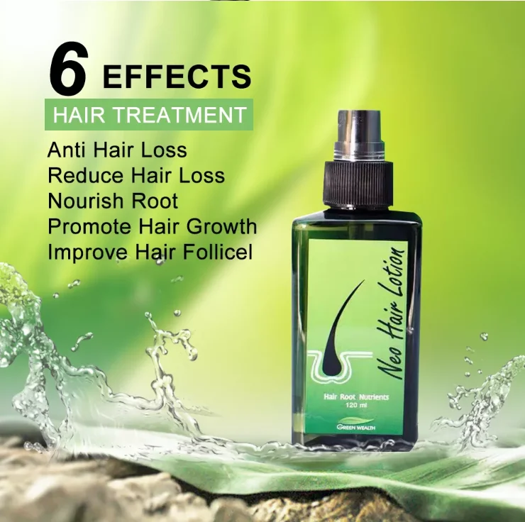 Original Neo Hair Lotion Treatment For Hair Growth Fast Moisturizer Hair Root 120ml Lotion Buy