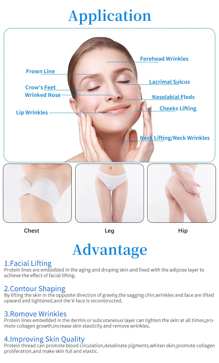 Good Price Suture Thread 21g 60mm Bidirectional Cog 4d With L Needle For Face Lift Pdo Thread Online Shopping