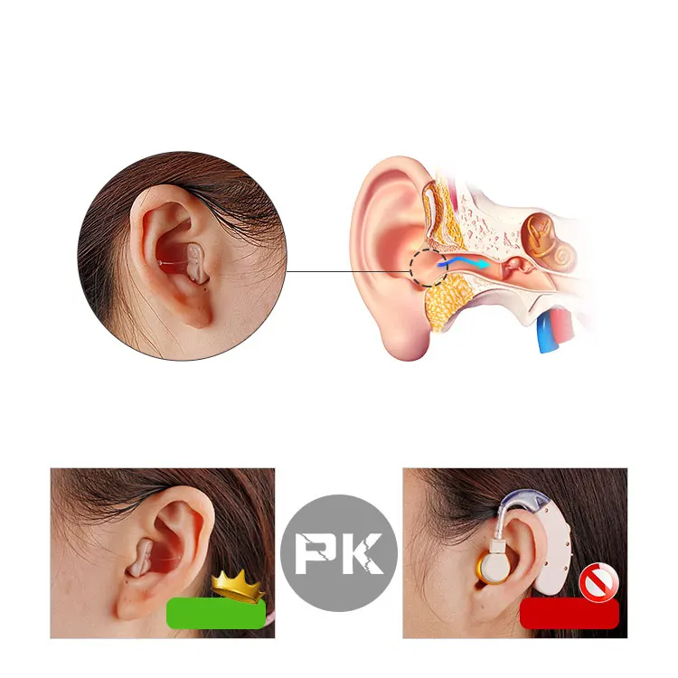 Analog ITE Hearing Aid for People with Poor Hearing manufacture