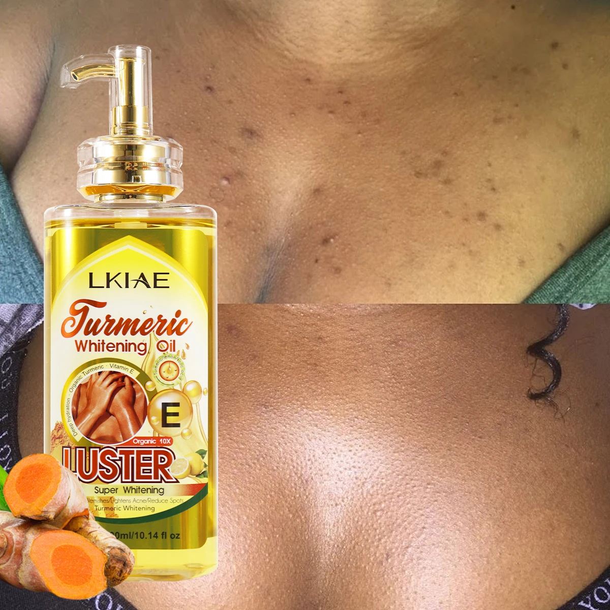glutathione body oil factory Wholesale Custom Kojic Acid Lemon Remove Blemishes Smooth Skin Brightening Whitening Turmeric Benefit_Luminous