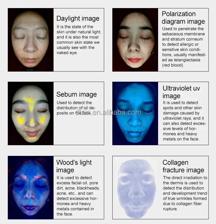 AI 3D Face Skin Analysis Test Wifi Digital Skin Analyzer 3D Face ...