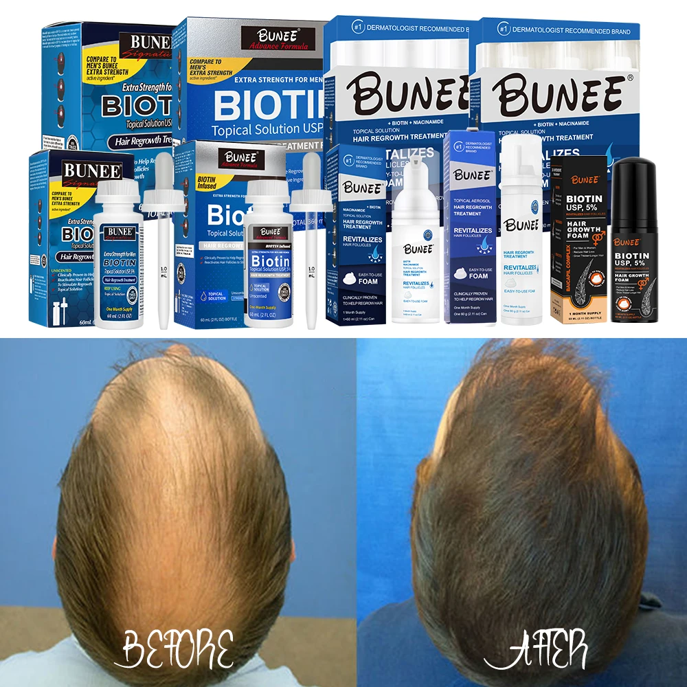 BUNEE Hair Growth Serum - Promotes Healthy Hair Regrowth