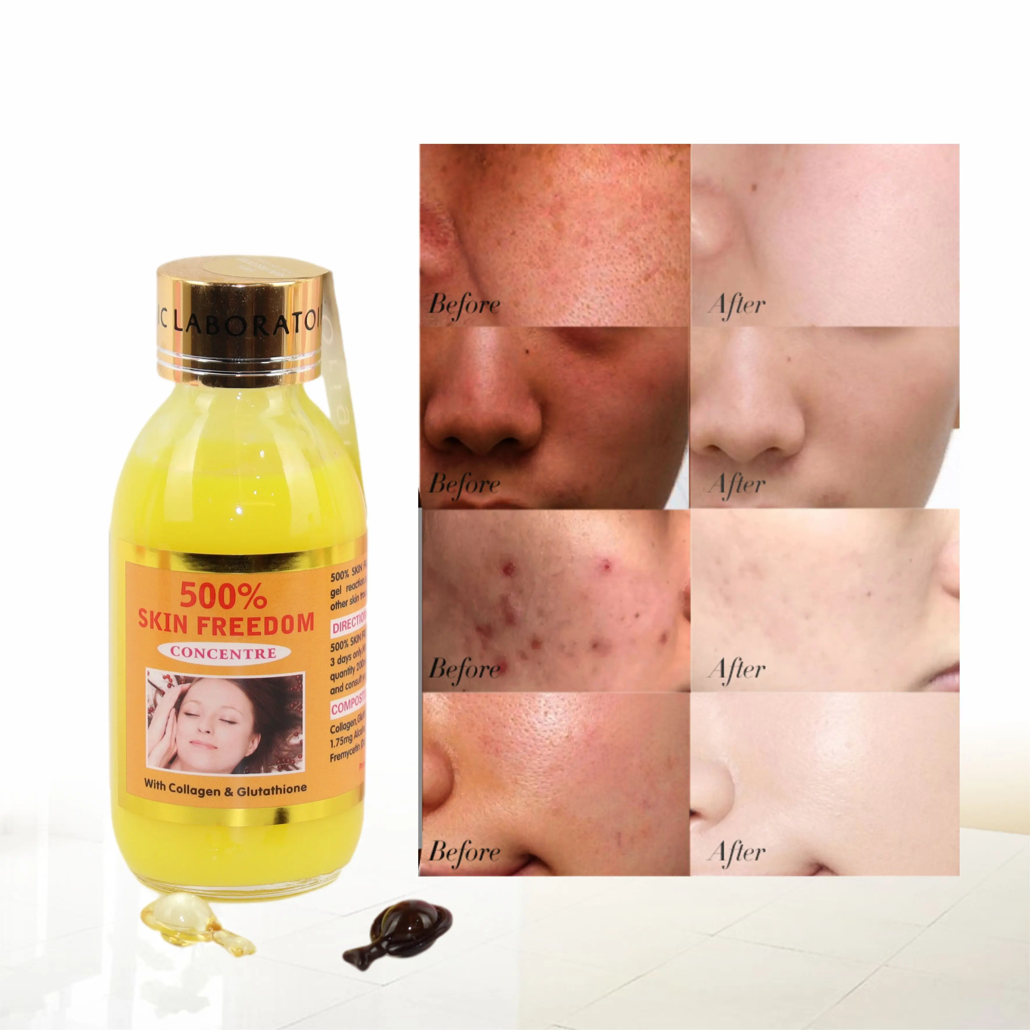 Private Label Vitamin C Repair Skin Care Dark Spots Removal Beauty  Whitening Firming Anti-Aging Microneedling Face Serum