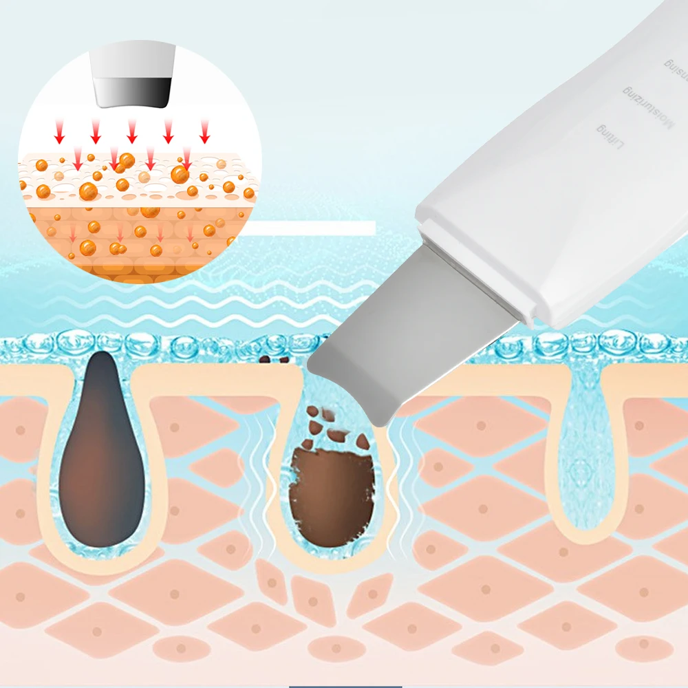 New Style  Cheap Personal Care White Black Ultrasonic Ion Professional Skin Scrubber.jpg