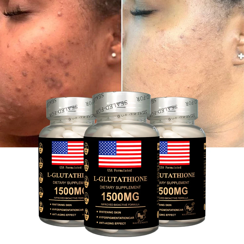 2025 Hot Selling the Best Glutathione Supplement for Healthy Skin Glowing  Lightening boost Immunity Glutathione Softgel Capsule| Alibaba.com