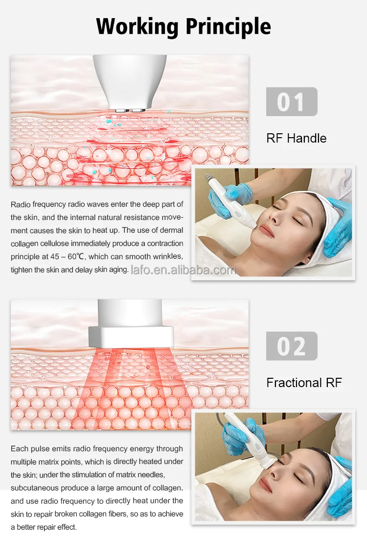 2 in 1 RF Wrinkle Remover Stretch Mark Removal Device Body Face Lift Skin Rejuvenation Rf Machine