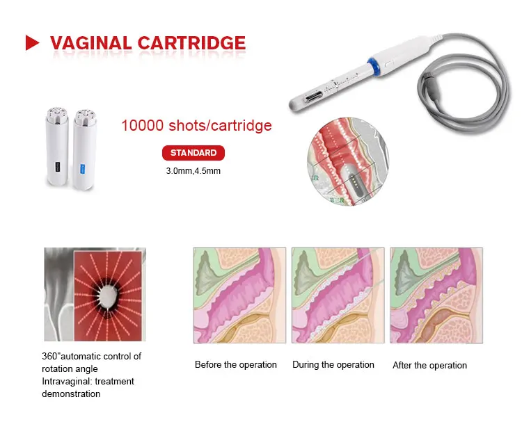 Китайский поставщик, машина 4D Hifu 5D 4D Hifu Liposonix для лица и тела