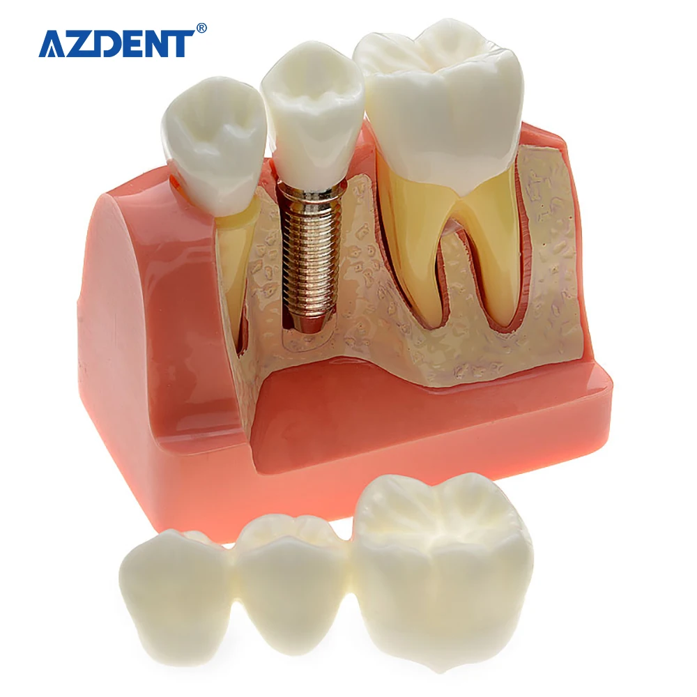 Baistra популярный продукт Стоматологическая портативная Смола съемная модель для анализа зубов