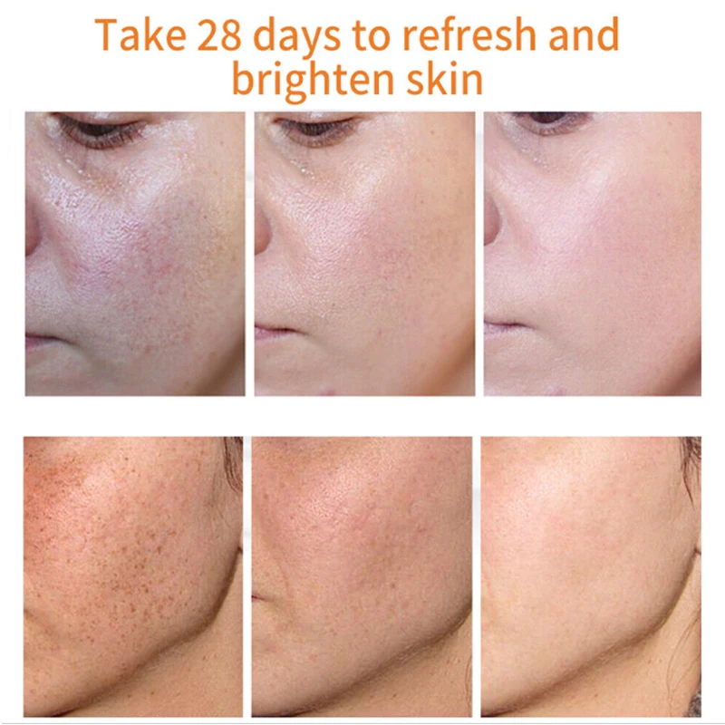 glutathione serum before and after AILKE BOOST LUSTER Double PLUS Super Whitening Serum, Moisturizing, Remove Dark Spots, Brightening, Lightening Skin, For Face & Body, 4.2 fl oz (1 Bottle) : Beauty & Personal Care manyo Glutathione 7 Dark Spot