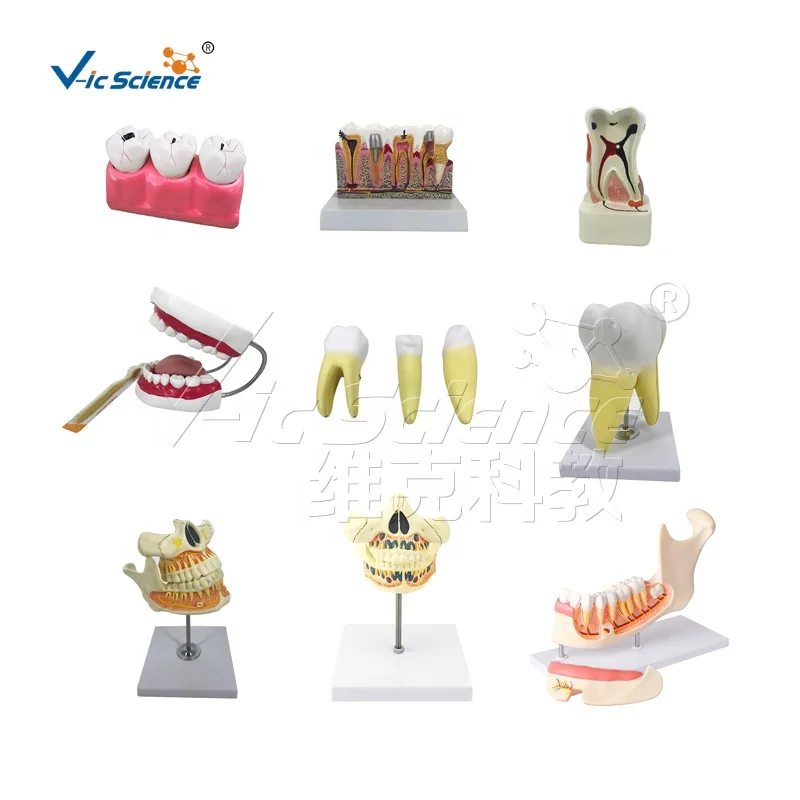 Caries Model Practice Teeth Nissin Dental Model| Alibaba.com