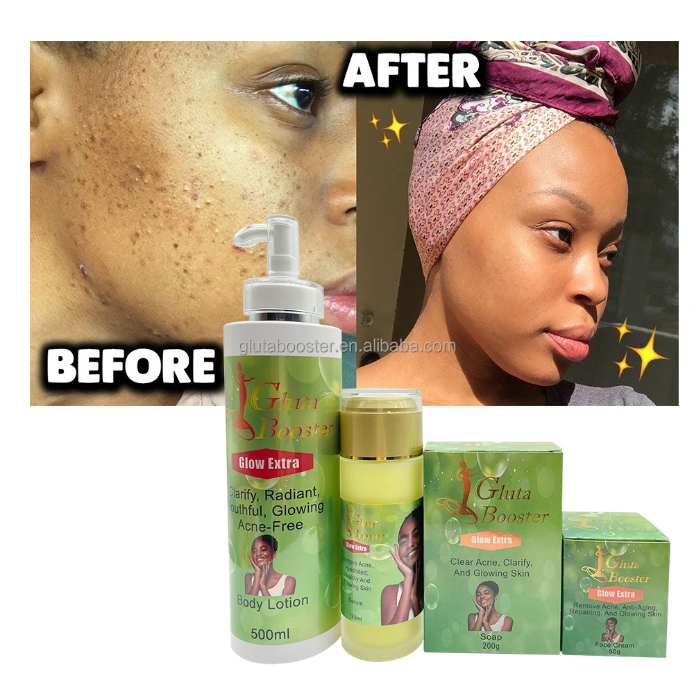 Skin Care Set For Glowing Skin Private Label Anti Acne Set Remove Pimples Clear Blemishes Clarify Repairing For African Beauty