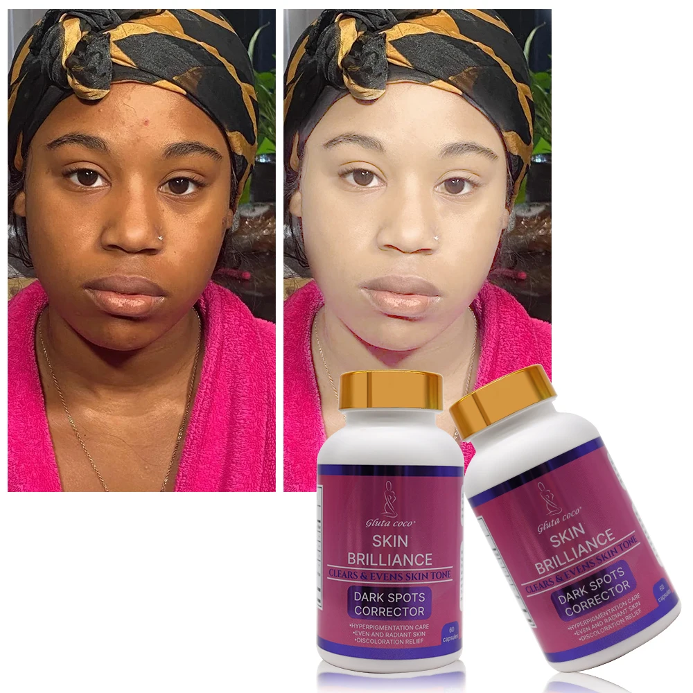 glutathion pour la peau ERIC FAVRE Shot Pure White 1000mg Healthy Monday : Les pouvoirs