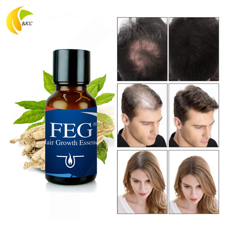 Feg Brand Stop Hair Loss Fast Hair Growth Products For Men And Woman Hair  Growth Serum - Buy Hair Growth Serum,Fast Hair Growth Products,Feg Hair  Growth Product on Alibaba.com