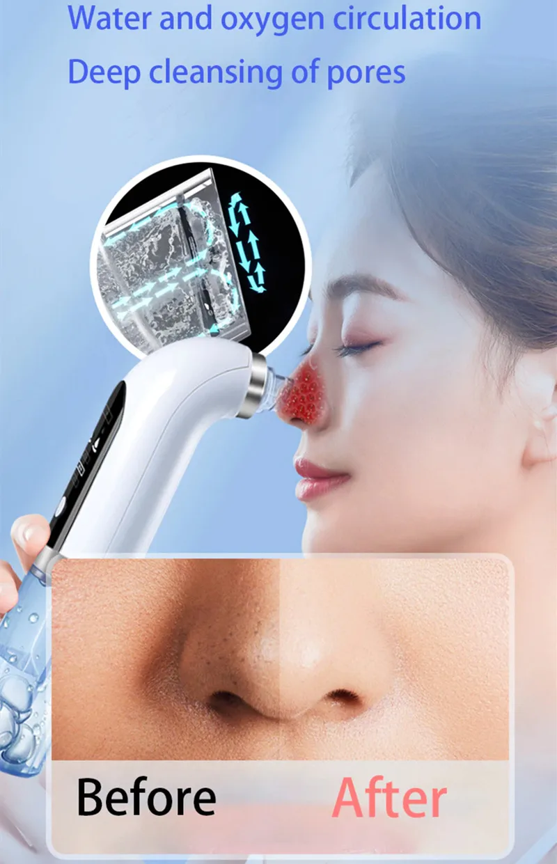  Blackhead Remover (5).jpg
