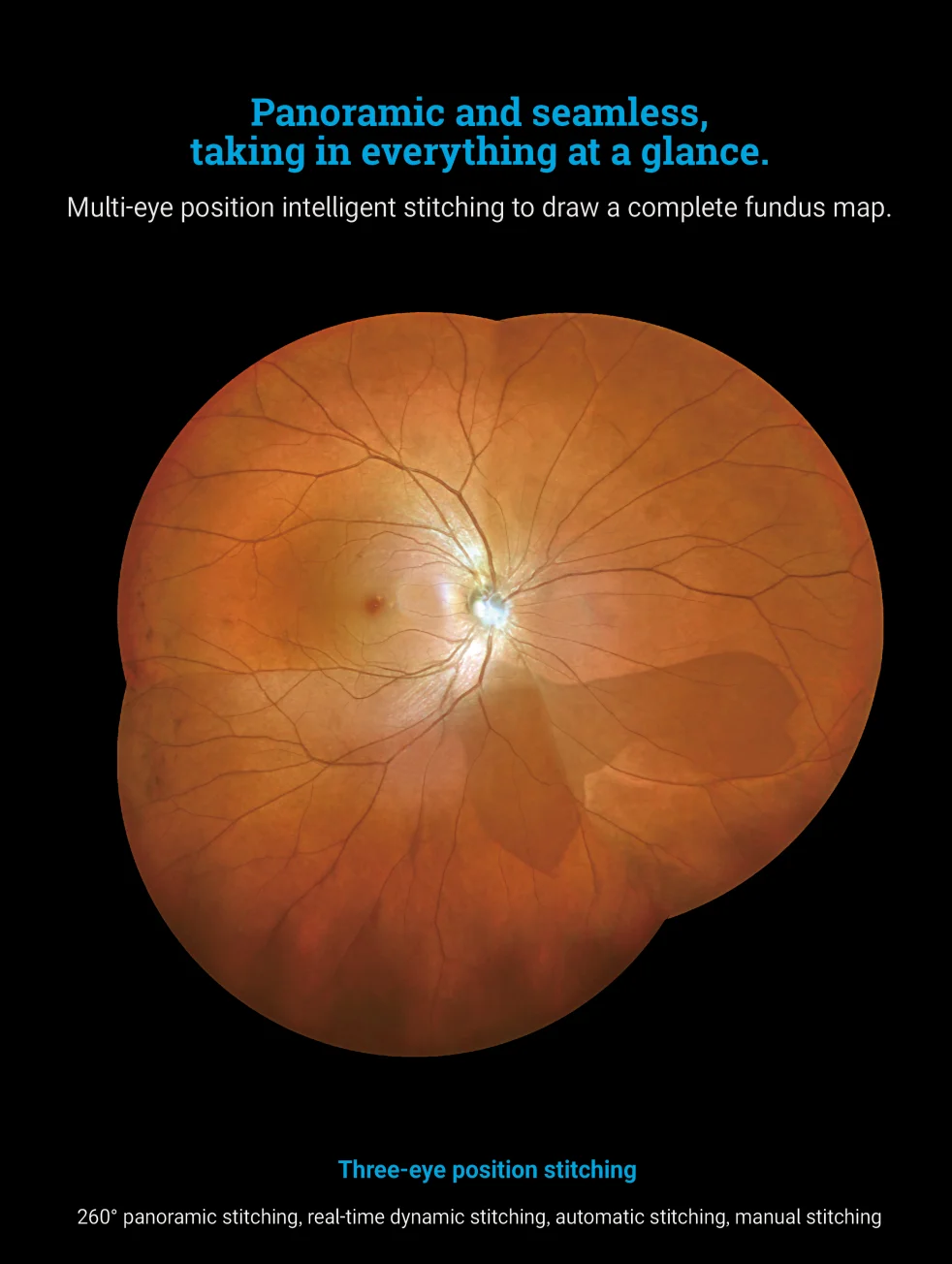 170&deg; Ultra Wide Field Fundus Imaging System Retinal Camera with Four Laser Sources and Automatic Eye Positioning