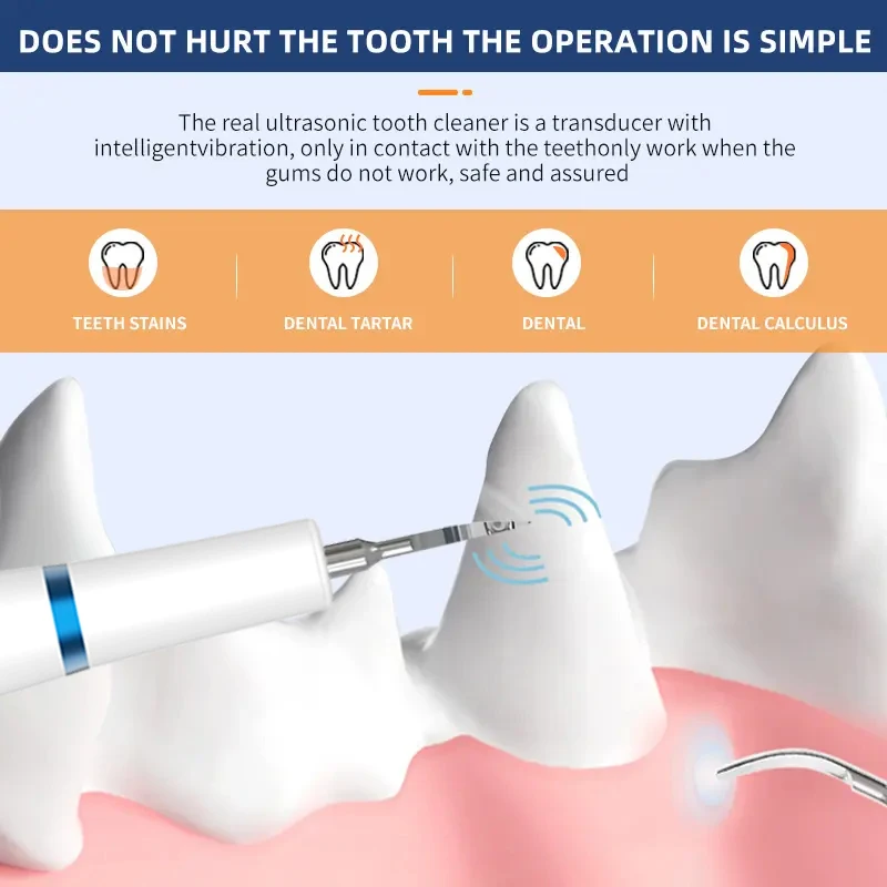 Ultrasonic Dog Teeth Cleaning Kit With LED Light for Pet  With 3 Modes for Teeth Care