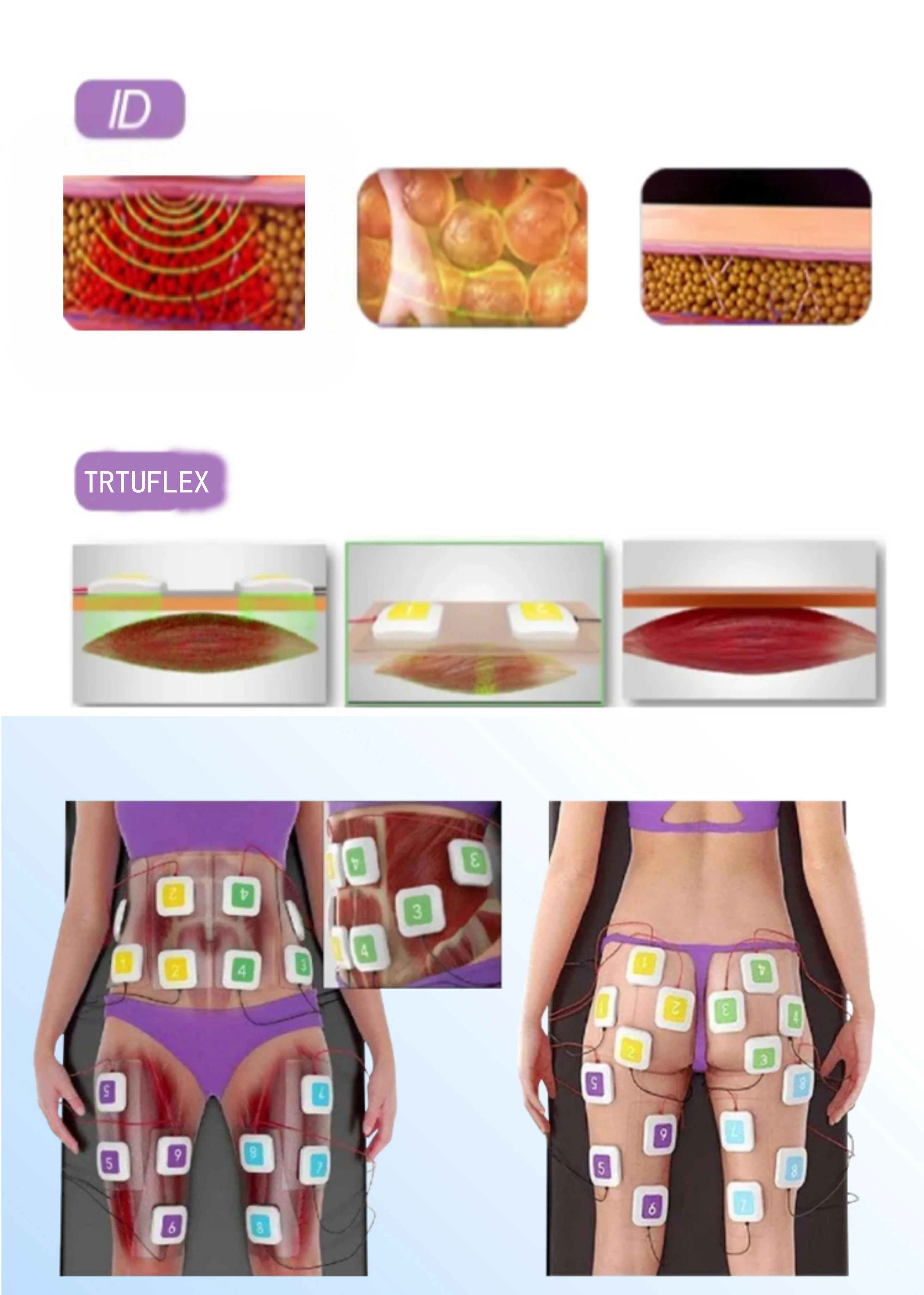 Beco 2024 Best Quality Ems Radio Frequency Fat Reduction Body Slimming for Weight Loss