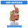 Intestino grueso con estómago (talla 12)