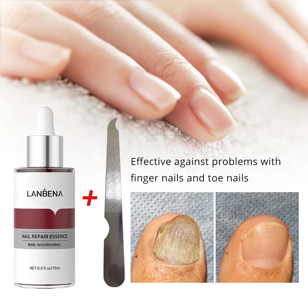 LANBENA Hot Sale Nail Essence Anti Fungus Nail Care Nourish Repair Serum factory