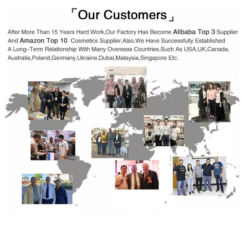 Effective Varicose Veins Relief Cream Relieve Vasculitis Phlebitis