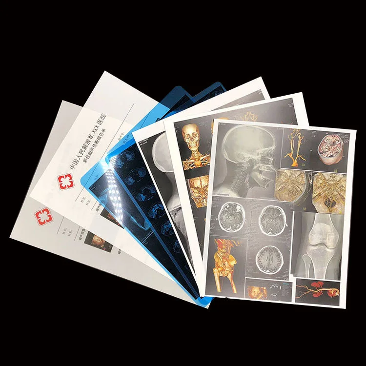 Inkjet Blue Medical Dry Film Transparent Blue Xray Film For CT DR MRI Radiological Device