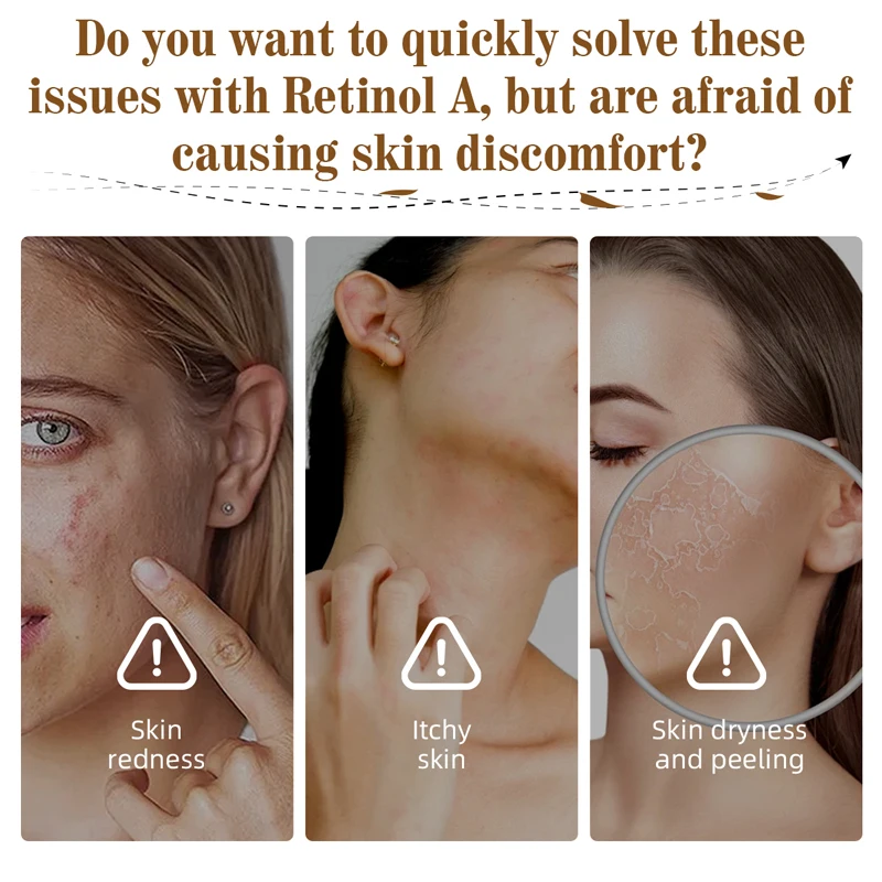 Best-Selling Lightens Fine Lines and Dark Spots Glowing Moisturizer Whitening Anti Aging Night Firming Retinol Facial Cream