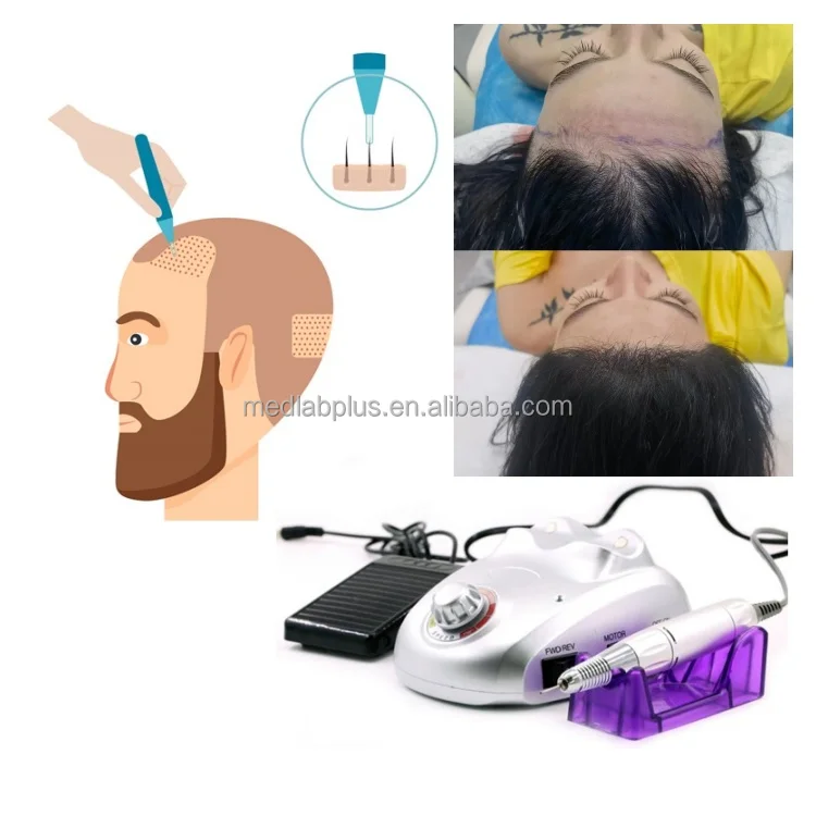 Manual Power Source Follicular Unit Extraction (FUE) Punch Machine Choi Implantor Choi Pen Hair Transplant Instruments