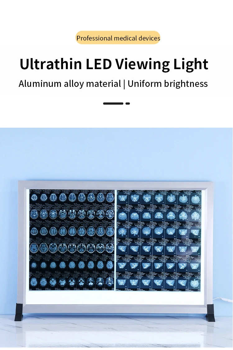 Single Panel LED X-Ray Film Viewer with Adjustable Brightness, Medical ...