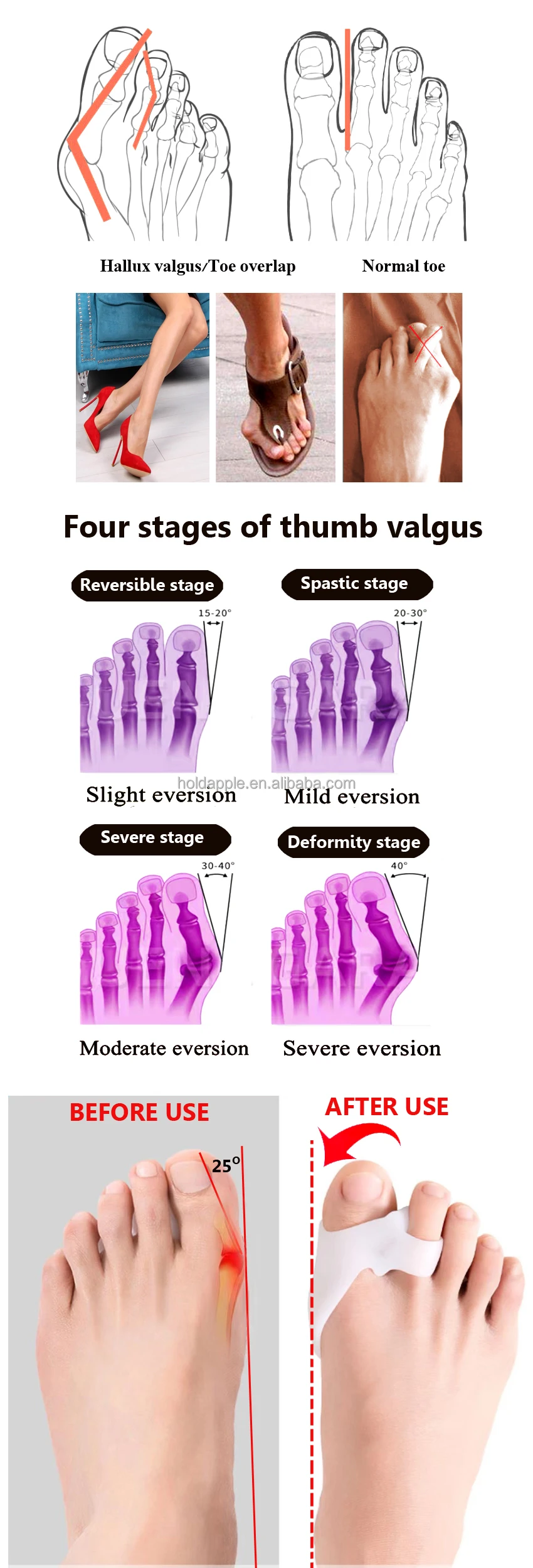 Finger Toe Shoes Toe Separators Pedicure Medicus Straighten Foot Splint Bunion Toe Separator HA00490