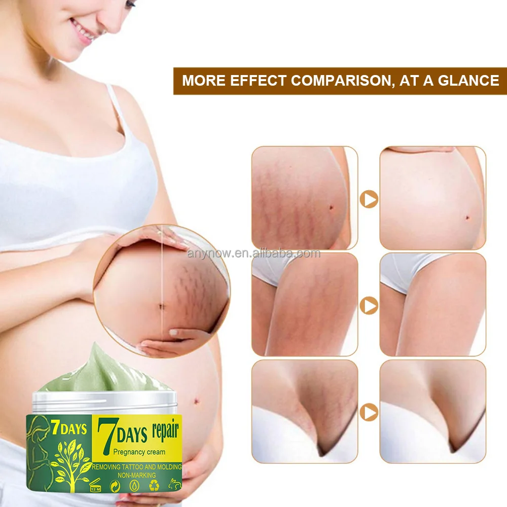  Stretch Marks Cream (4).jpg