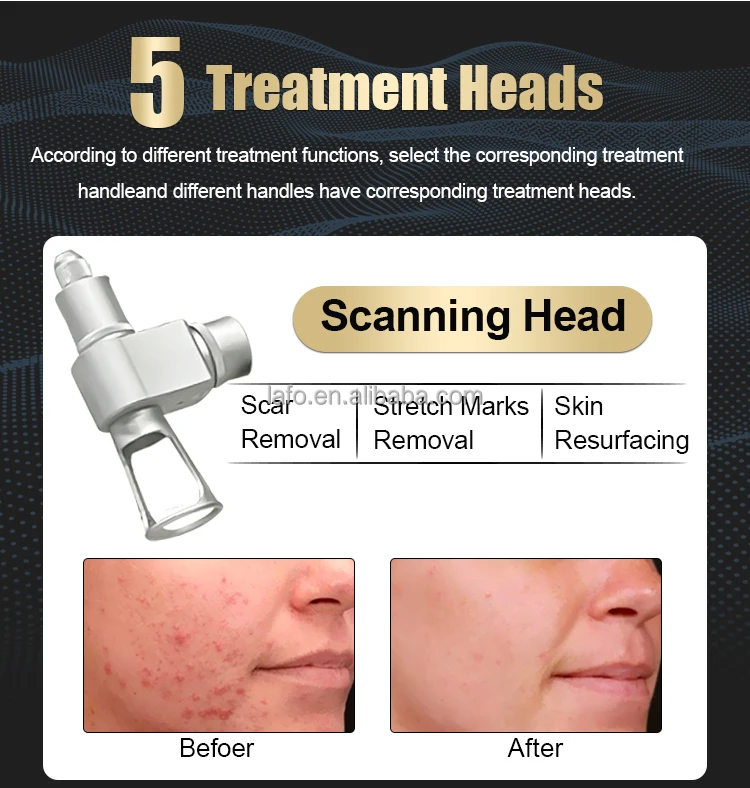 HOT portable 10600nm Fractional CO2 laser l tightening rejuvenation CO2 laser machine for scar removal