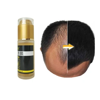 Brand customized wholesale hair growth oil with mint how you make your hair grow