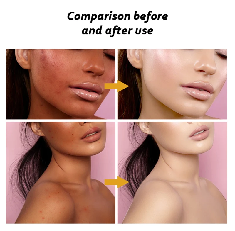 glutathione iv macomb Glutathione – MCCM Medical Cosmetics