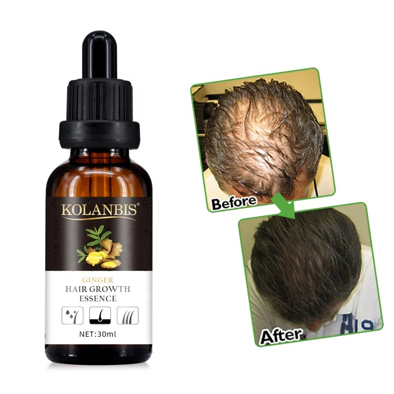Фирменная Сыворотка для роста волос, 30 мл, индивидуальная Сыворотка для восстановления волос, Оптовая продажа, лечение выпадения волос, Тонизирующее масло OEM ODM